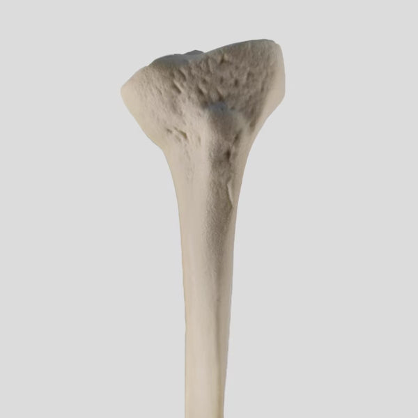HTO specific simulated bone forproximal tibialinversion deformity