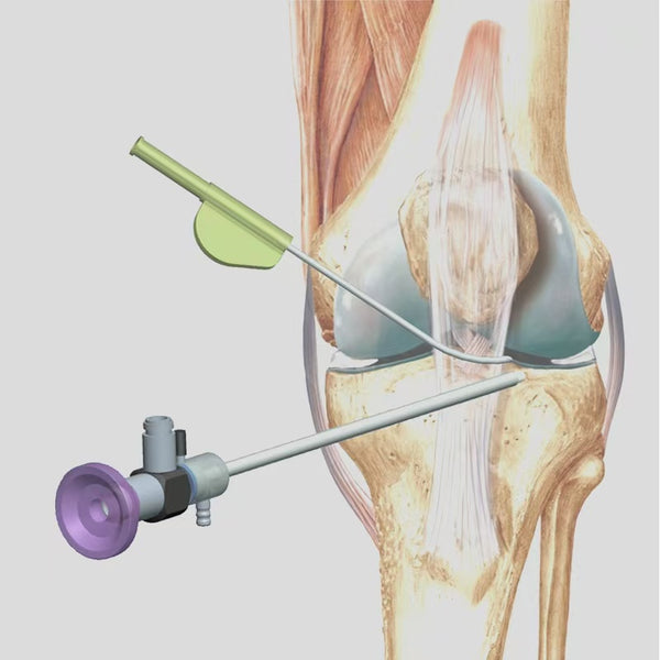Arthroscopy Training Simulator