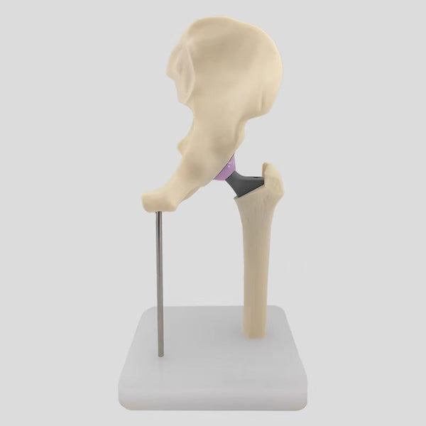 Hip replacement surgery model
