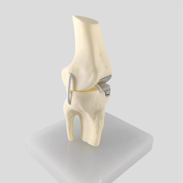 Total knee replacement model