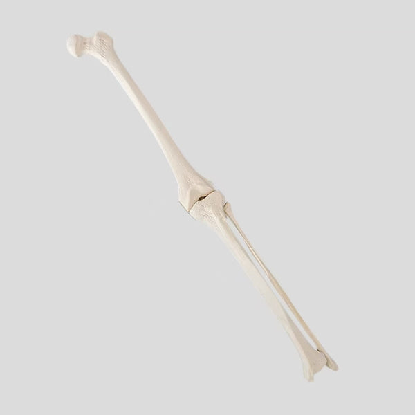 lmaging simulation of femoraltibialfibular connection