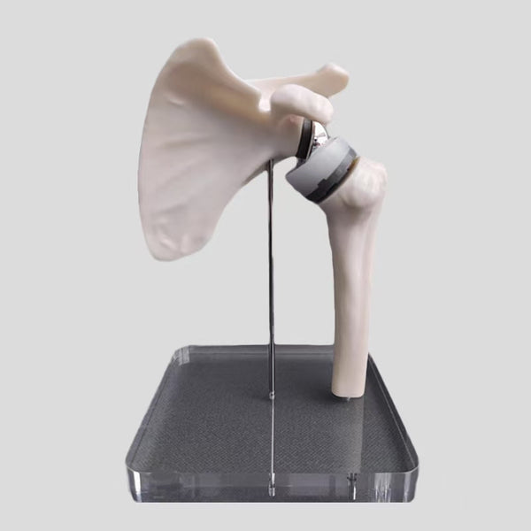 Simulation model of shoulder joint replacement surgery